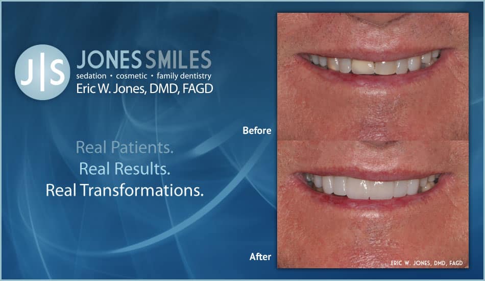 Implant and Cosmetic Dentistry Buford, GA